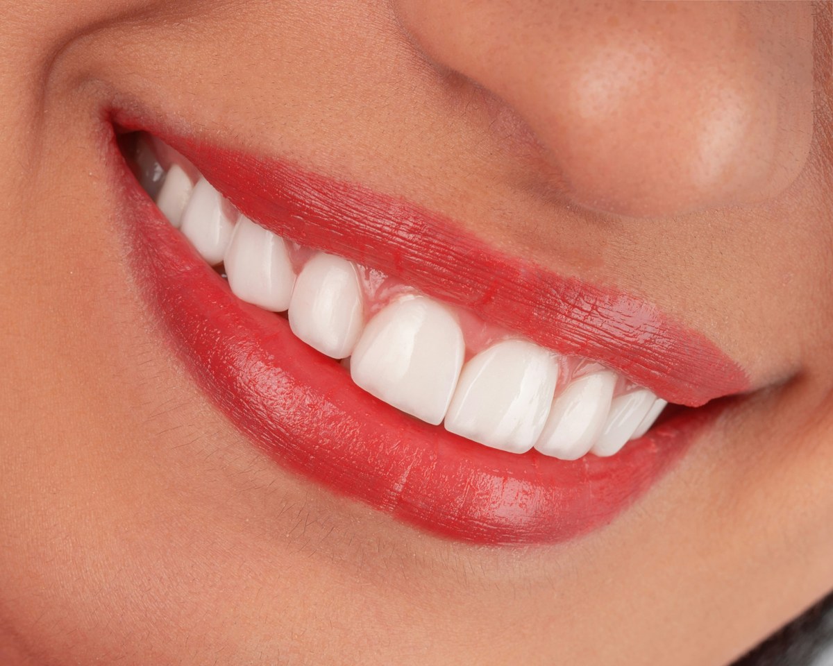 A close-up of a bright white smile with red lipstick